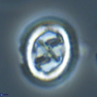 Chiasmolithus edentulus 20279