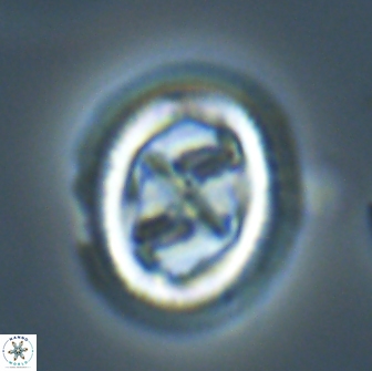 Chiasmolithus edentulus 20279