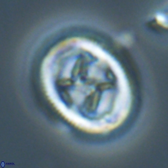 Chiasmolithus edentulus 20281