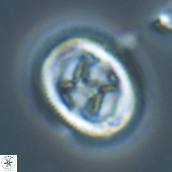 Chiasmolithus edentulus 20281