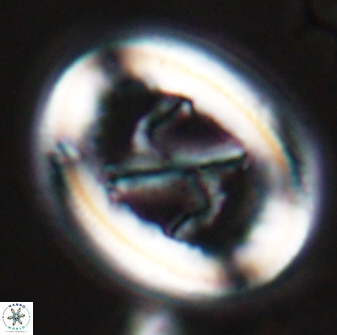 Chiasmolithus edentulus 25075