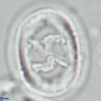 Chiasmolithus edentulus 25079