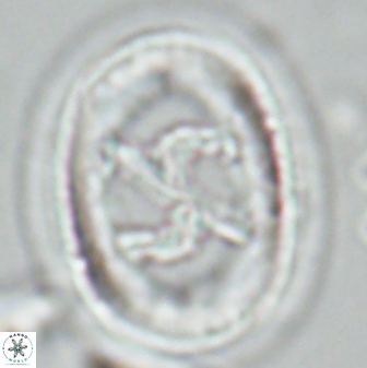 Chiasmolithus edentulus 25079