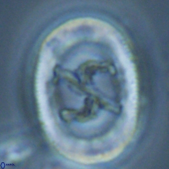 Chiasmolithus edentulus 25080