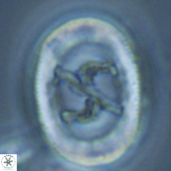 Chiasmolithus edentulus 25080