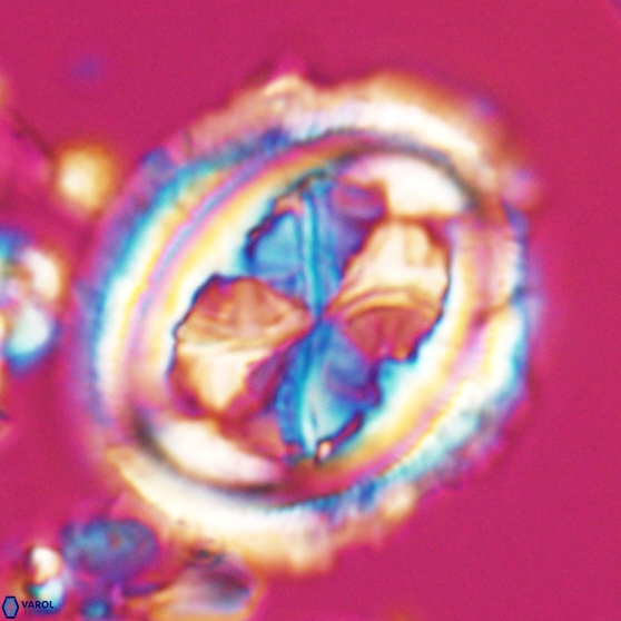 Chiasmolithus grandis 26021