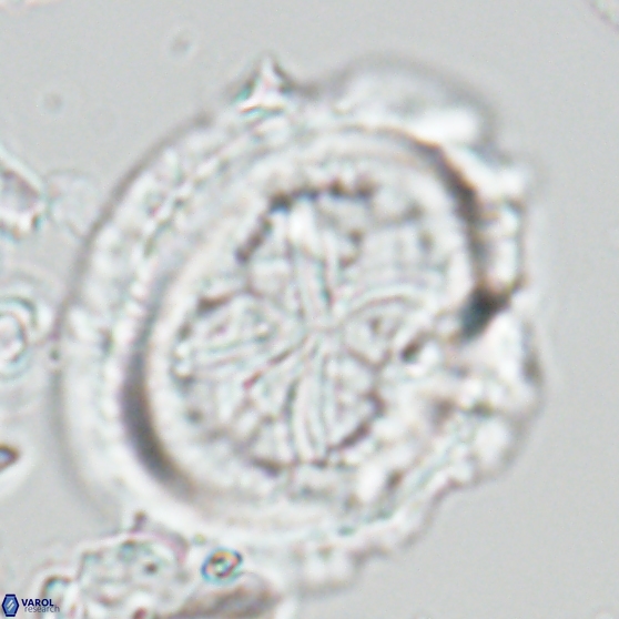 Chiasmolithus grandis 26027