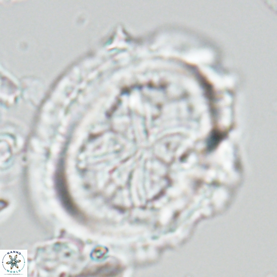Chiasmolithus grandis 26027