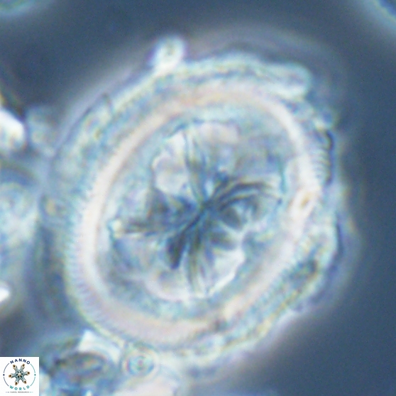 Chiasmolithus grandis 26028