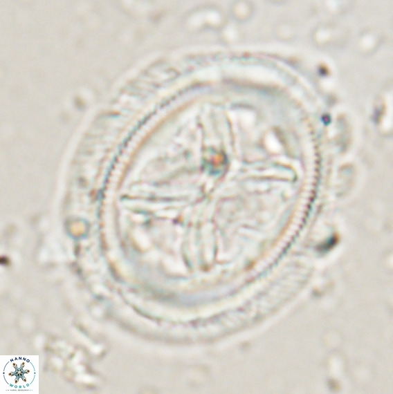 Chiasmolithus grandis VR 024711
