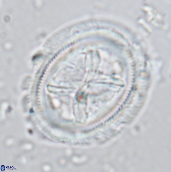 Chiasmolithus grandis VR 03132