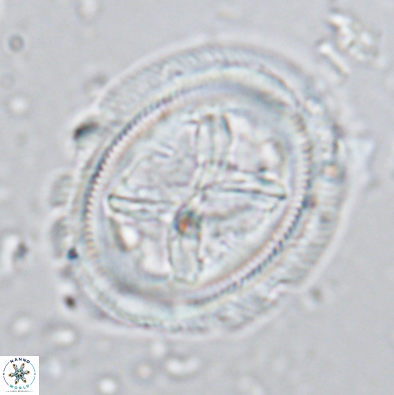 Chiasmolithus grandis VR 03132