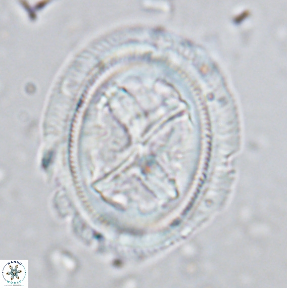 Chiasmolithus grandis VR 03133