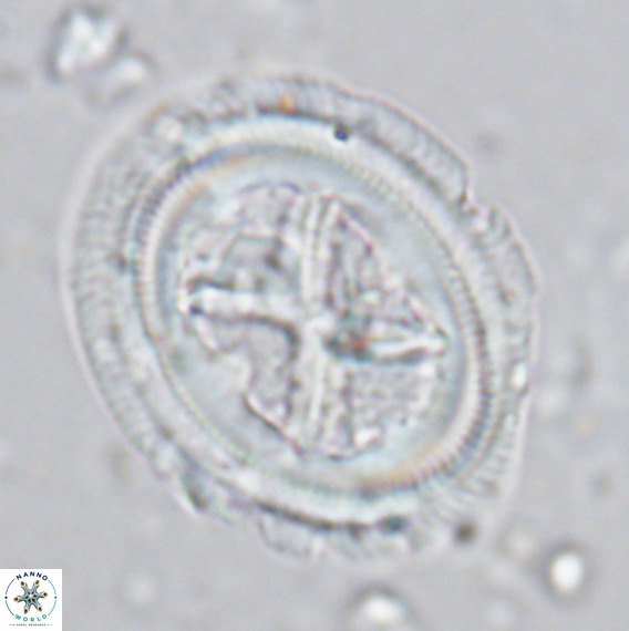 Chiasmolithus grandis VR 03135