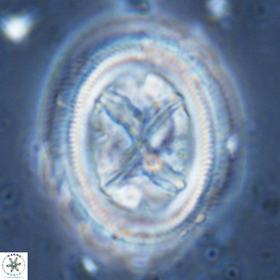 Chiasmolithus grandis VR 03138