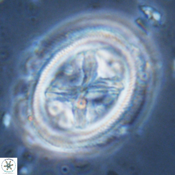 Chiasmolithus grandis VR 03140
