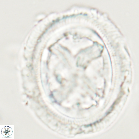 Chiasmolithus grandis VR 30933