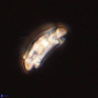 Chiasmolithus solitus 57823