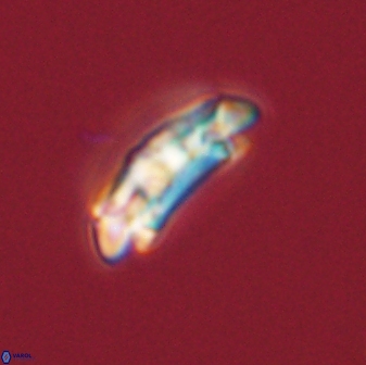 Chiasmolithus solitus 57824