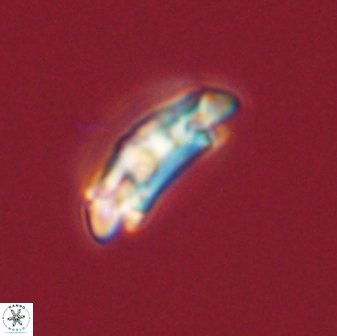 Chiasmolithus solitus 57824