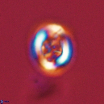 Chiasmolithus solitus 57827