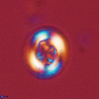 Chiasmolithus solitus 57828