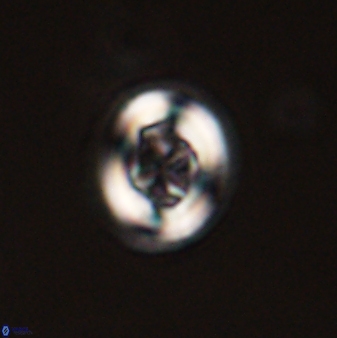 Chiasmolithus solitus 57829