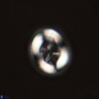 Chiasmolithus solitus 57830