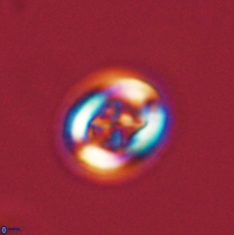 Chiasmolithus solitus 57832