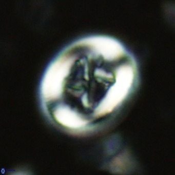 Chiasmolithus solitus VR 02424