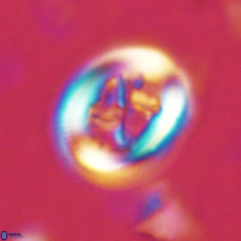 Chiasmolithus solitus VR 02425