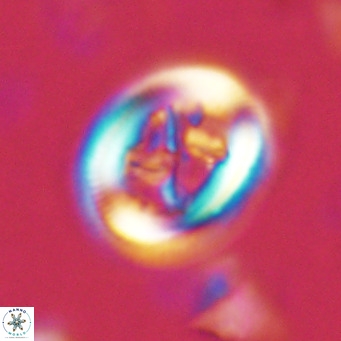 Chiasmolithus solitus VR 02425