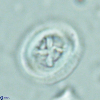 Chiasmolithus solitus VR 02426