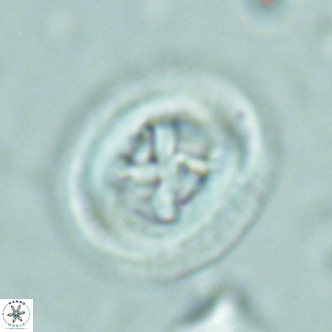Chiasmolithus solitus VR 02426