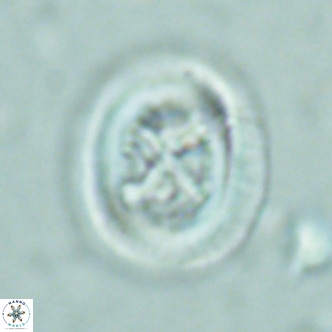 Chiasmolithus solitus VR 02427