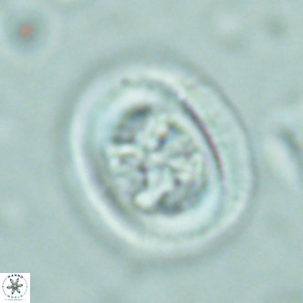 Chiasmolithus solitus VR 02428