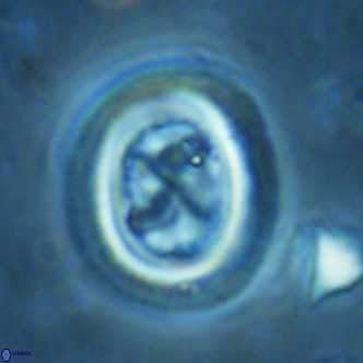 Chiasmolithus solitus VR 02430