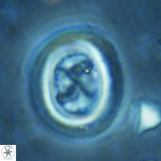 Chiasmolithus solitus VR 02430