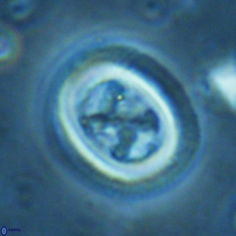 Chiasmolithus solitus VR 02431