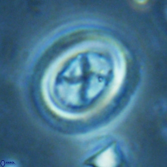 Chiasmolithus solitus VR 02432