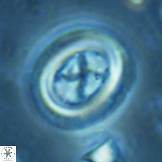 Chiasmolithus solitus VR 02432