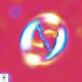 Chiasmolithus solitus VR 024724