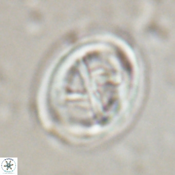 Chiasmolithus solitus VR 024726