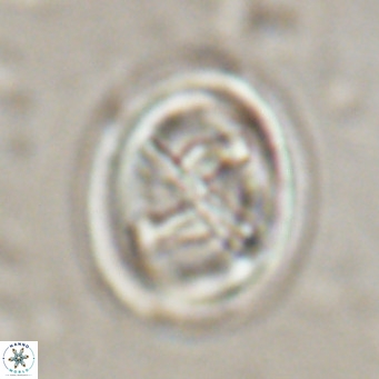 Chiasmolithus solitus VR 024727