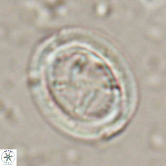 Chiasmolithus solitus VR 024728