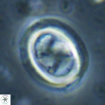 Chiasmolithus solitus VR 024729