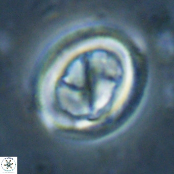Chiasmolithus solitus VR 024731