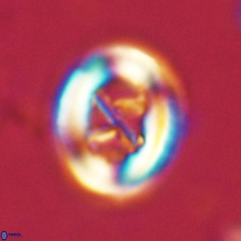 Chiasmolithus solitus VR 02621