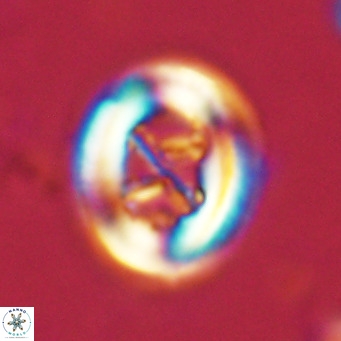 Chiasmolithus solitus VR 02623