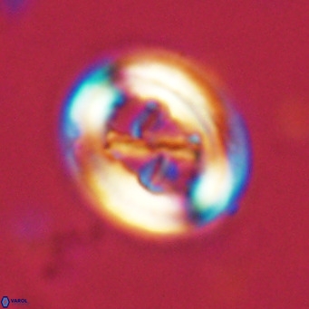 Chiasmolithus solitus VR 02624